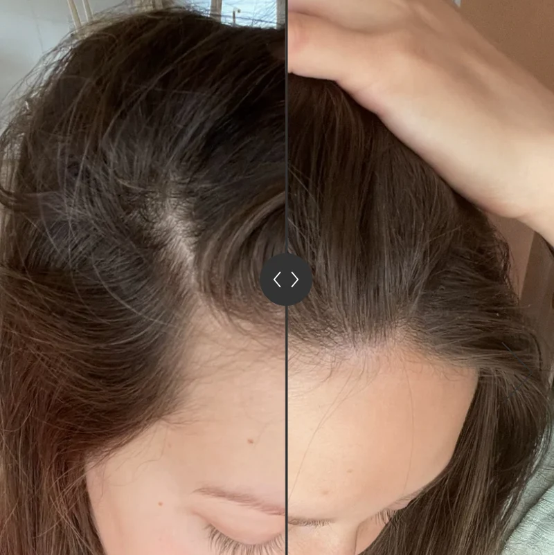 SoKind Pure Groei Serum