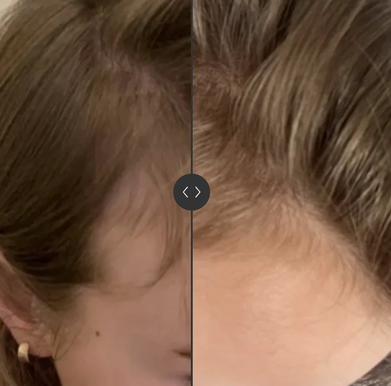 SoKind Pure Groei Serum