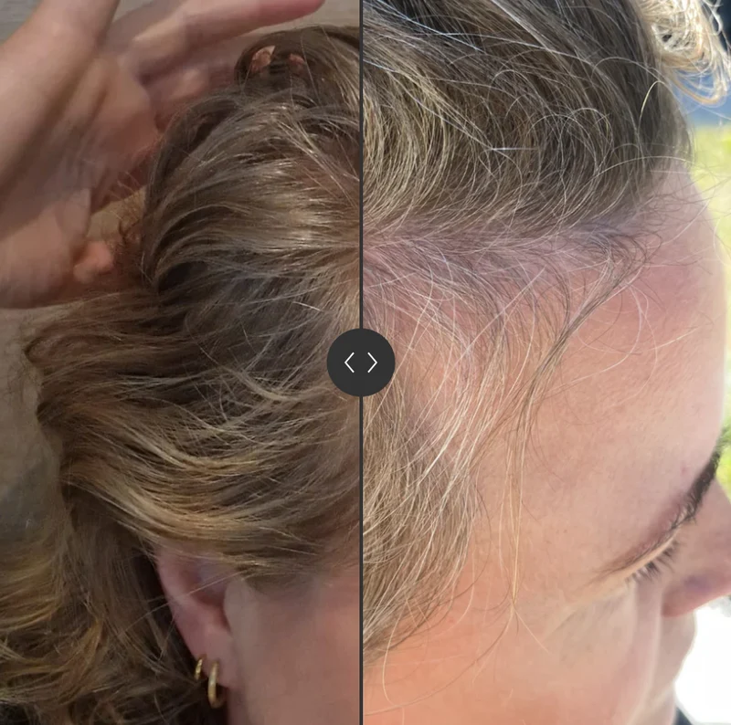 SoKind Pure Groei Serum
