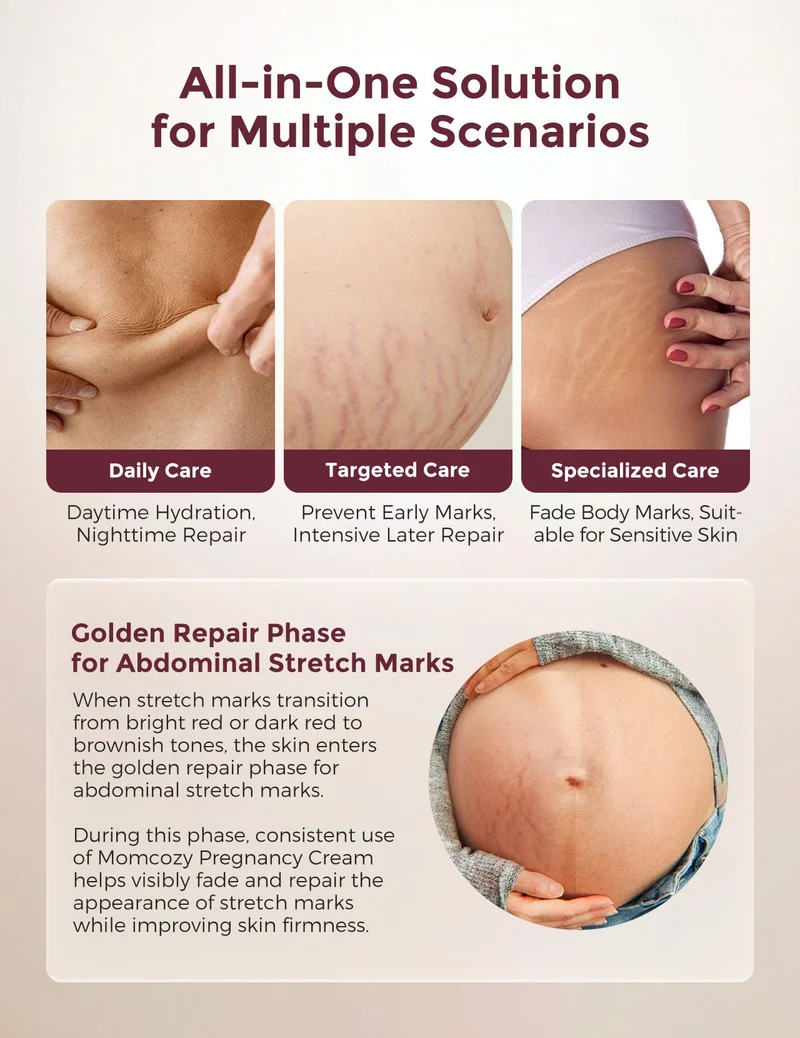 Momcozy Pro-Collagen Belly Firming Moisturizer