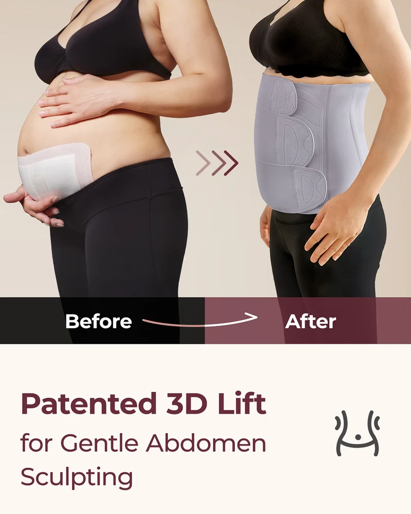 Momcozy Ergowrap Rückbildungsband